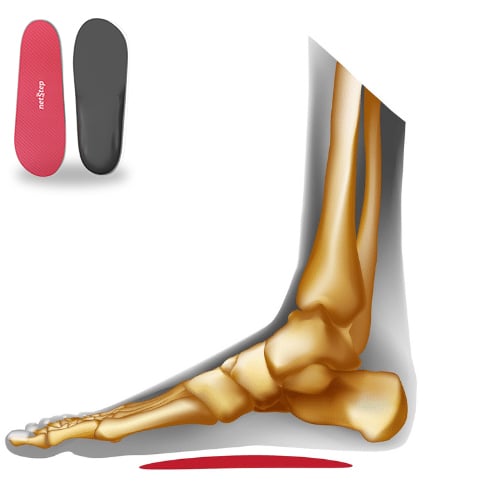 Custom Flat Feet Orthotics