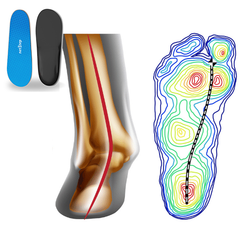 Custom Orthotics For Pronation