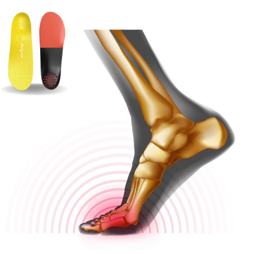 Custom Metatarsalgia Orthotics - Netstep