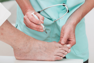 What Are Bunions - surgical