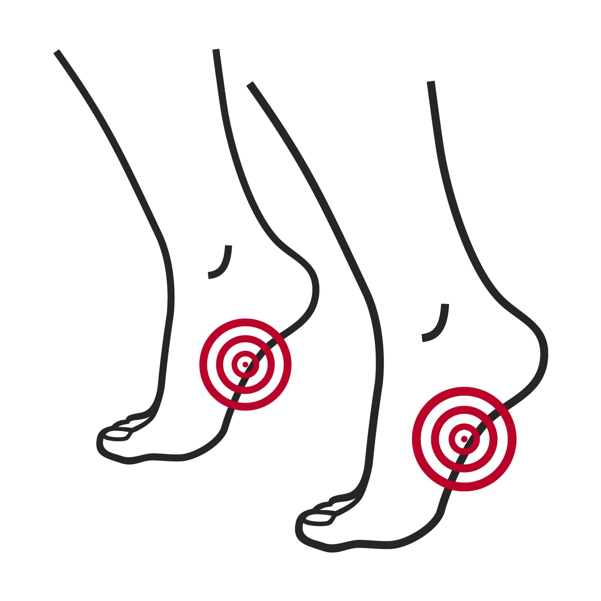 overpronation walking