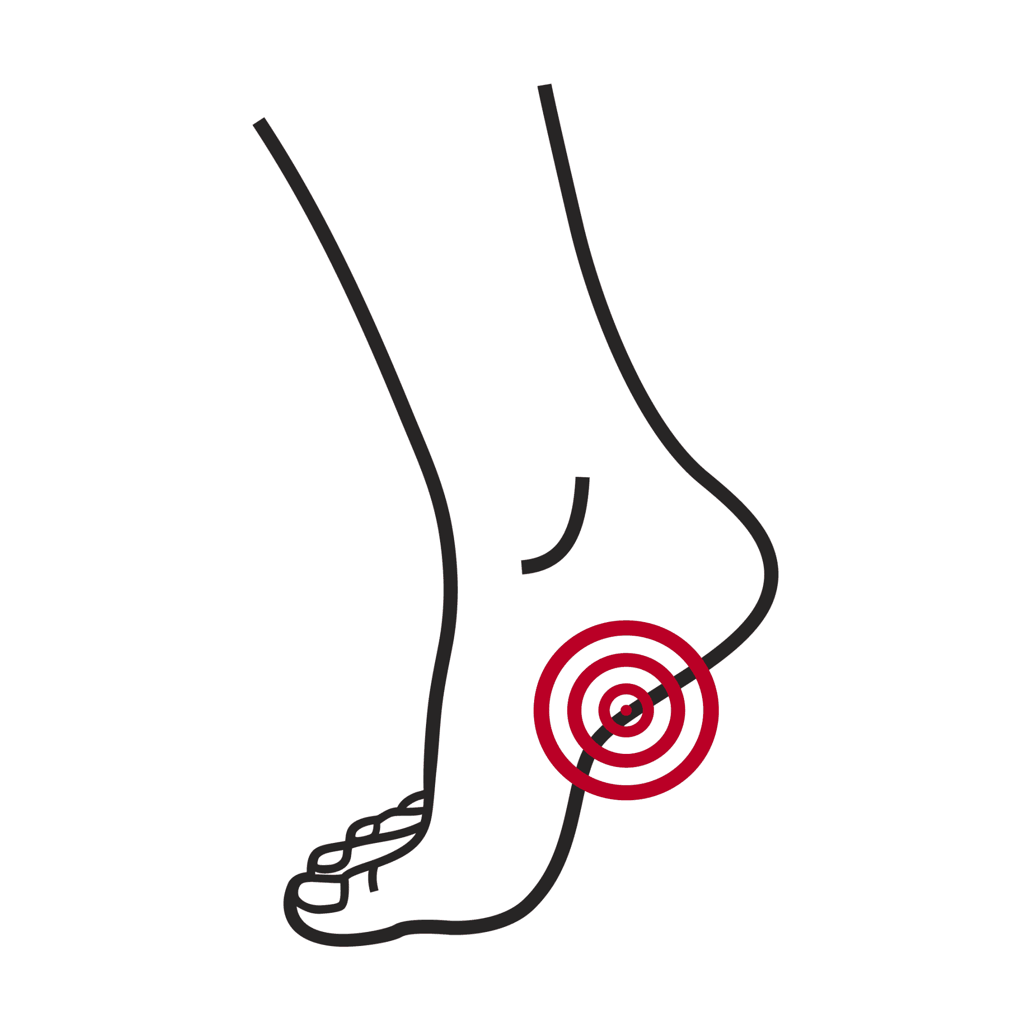 Plantar Fasciitis Netstep